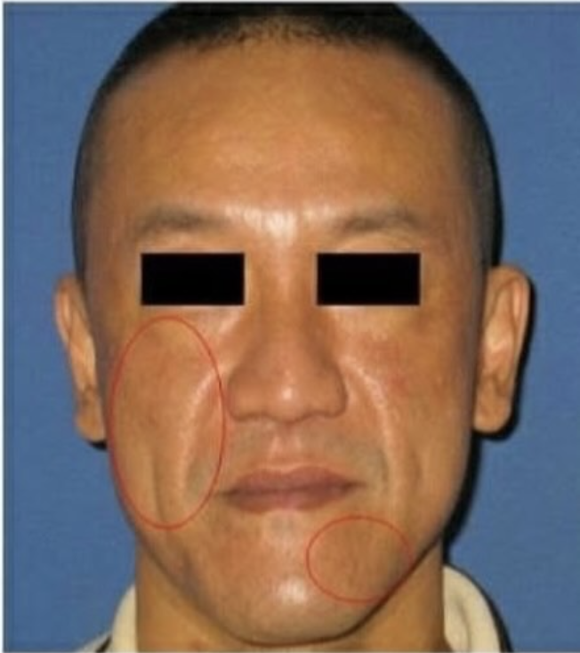 截取要辨識的部分